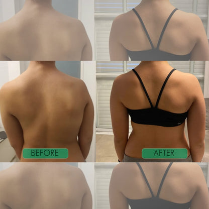 Instant Posture Corrector with Adjustable Ergonomic Support