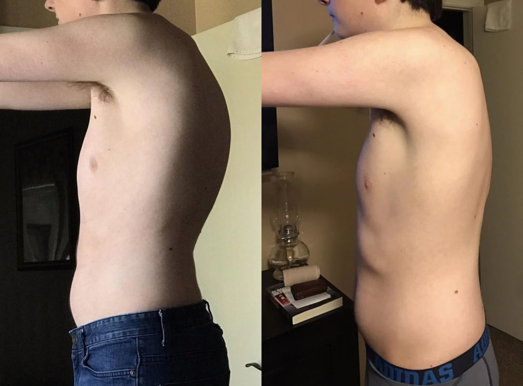 Instant Posture Corrector with Adjustable Ergonomic Support