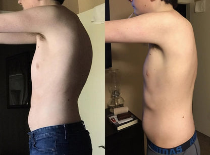 Instant Posture Corrector with Adjustable Ergonomic Support
